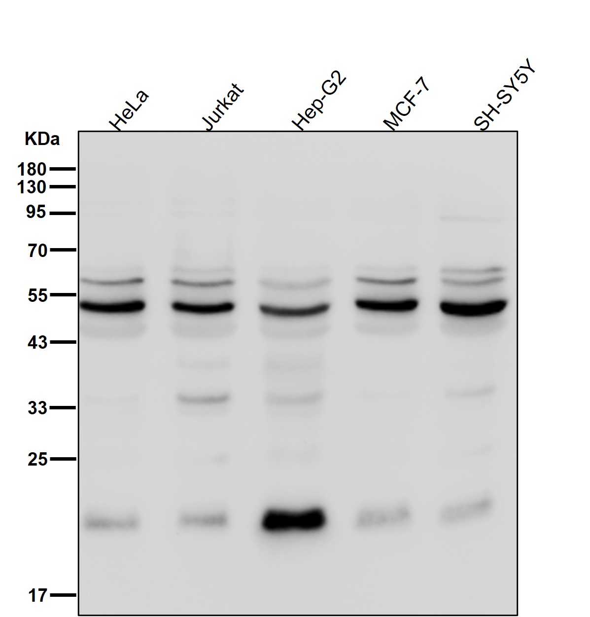 Rabbit Monoclonal to HARS