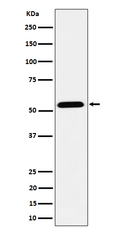 ENPP5