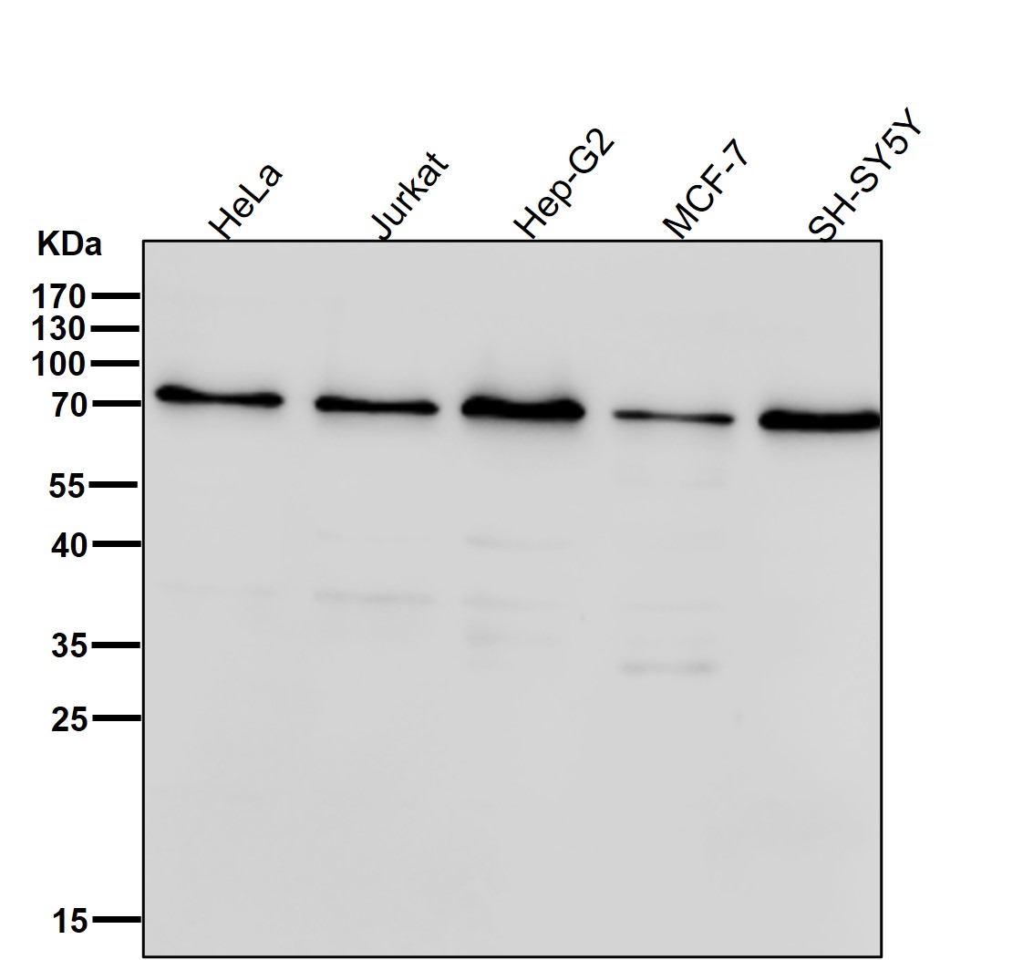 Rabbit Monoclonal to ALDH16A1