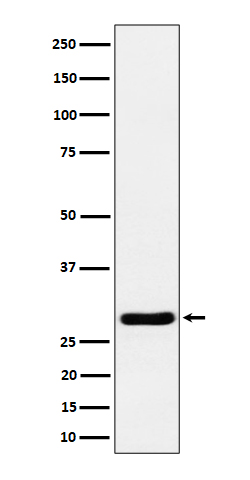 Calcipressin 1