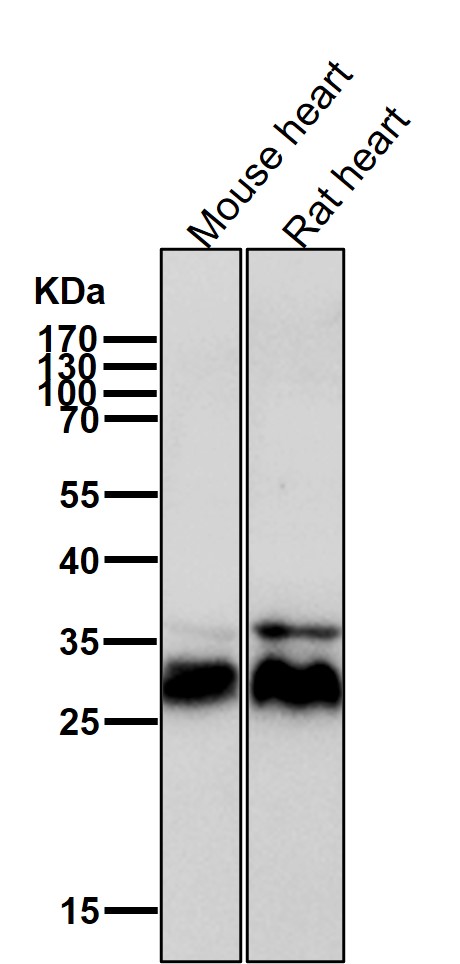 Rabbit Monoclonal to Calcipressin 1