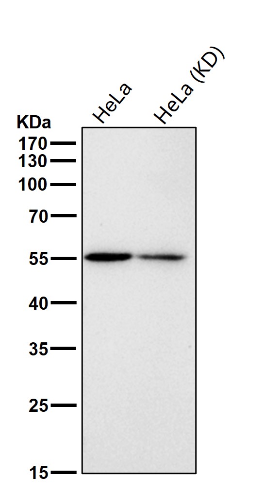 Rabbit Monoclonal to p60 katanin