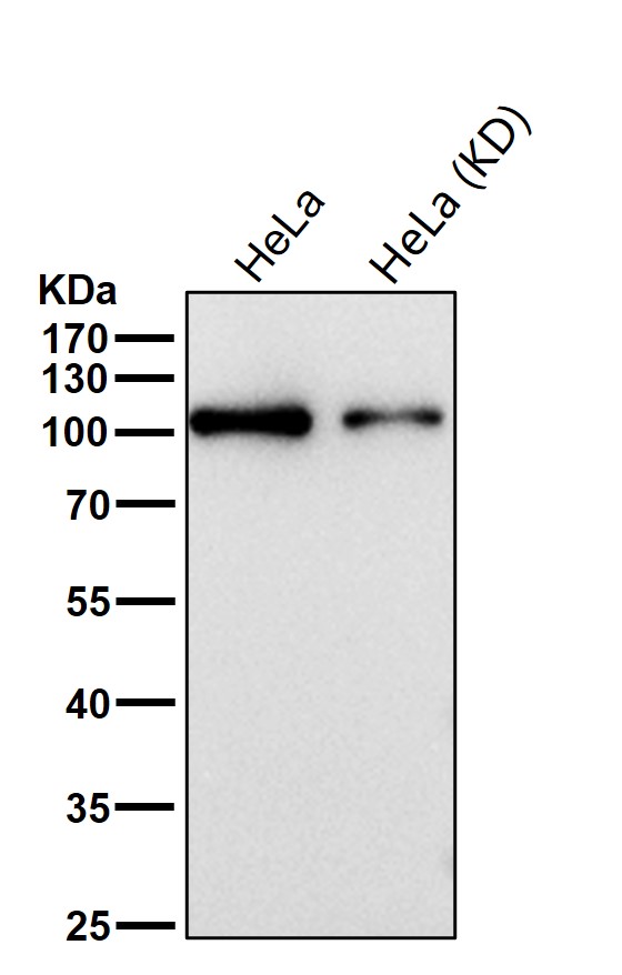 Rabbit Monoclonal to ZHX2