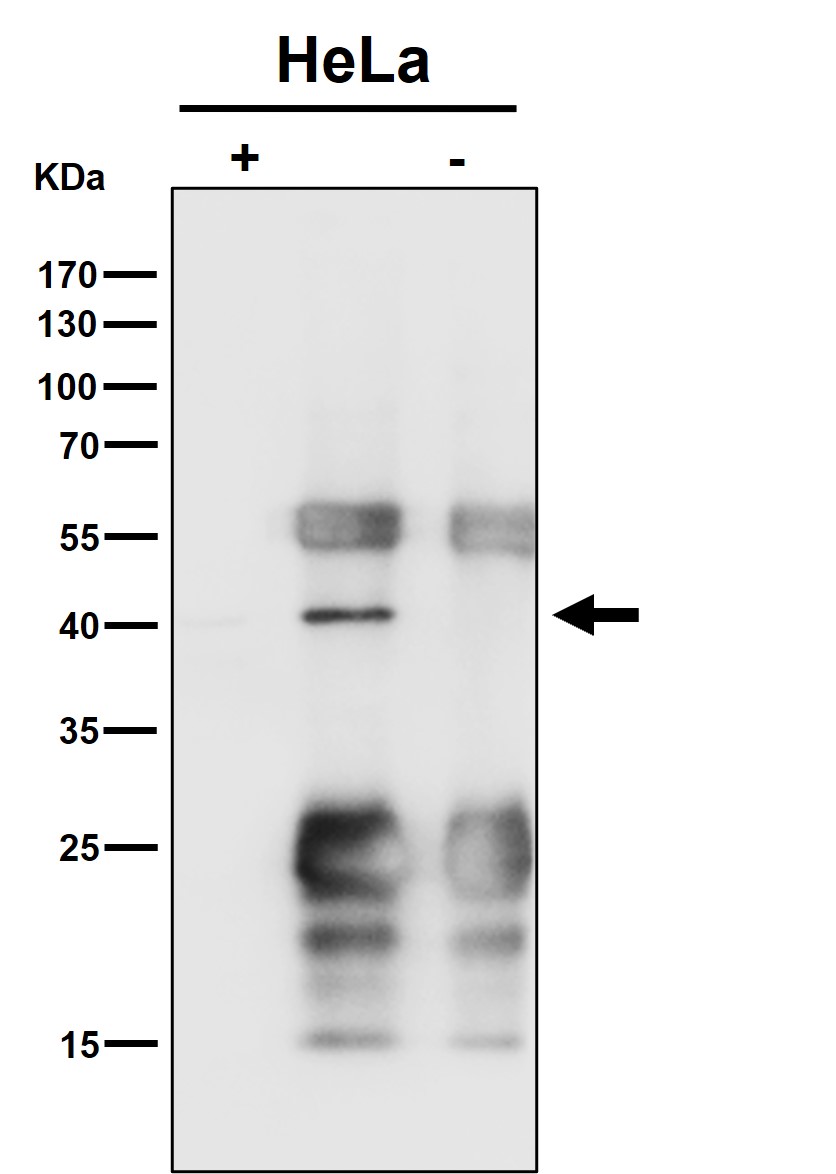 Rabbit Monoclonal to ENDOGL1/ENGL
