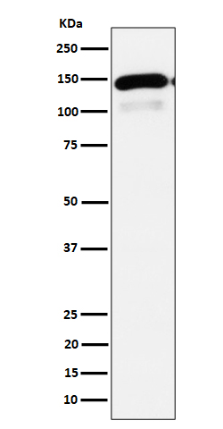 PLCB1