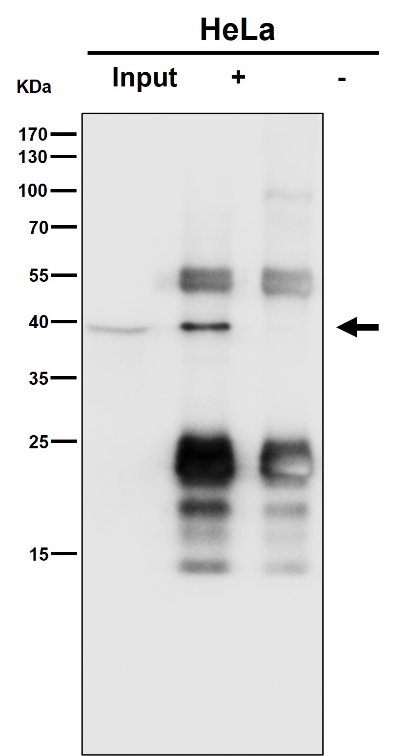 Rabbit Monoclonal to SLP2