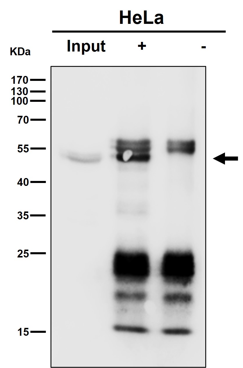 Rabbit Monoclonal to HIF Prolyl Hydroxylases