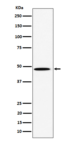 HIF Prolyl Hydroxylases