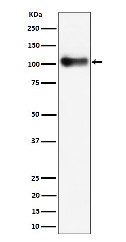 Thrombomodulin/CD141