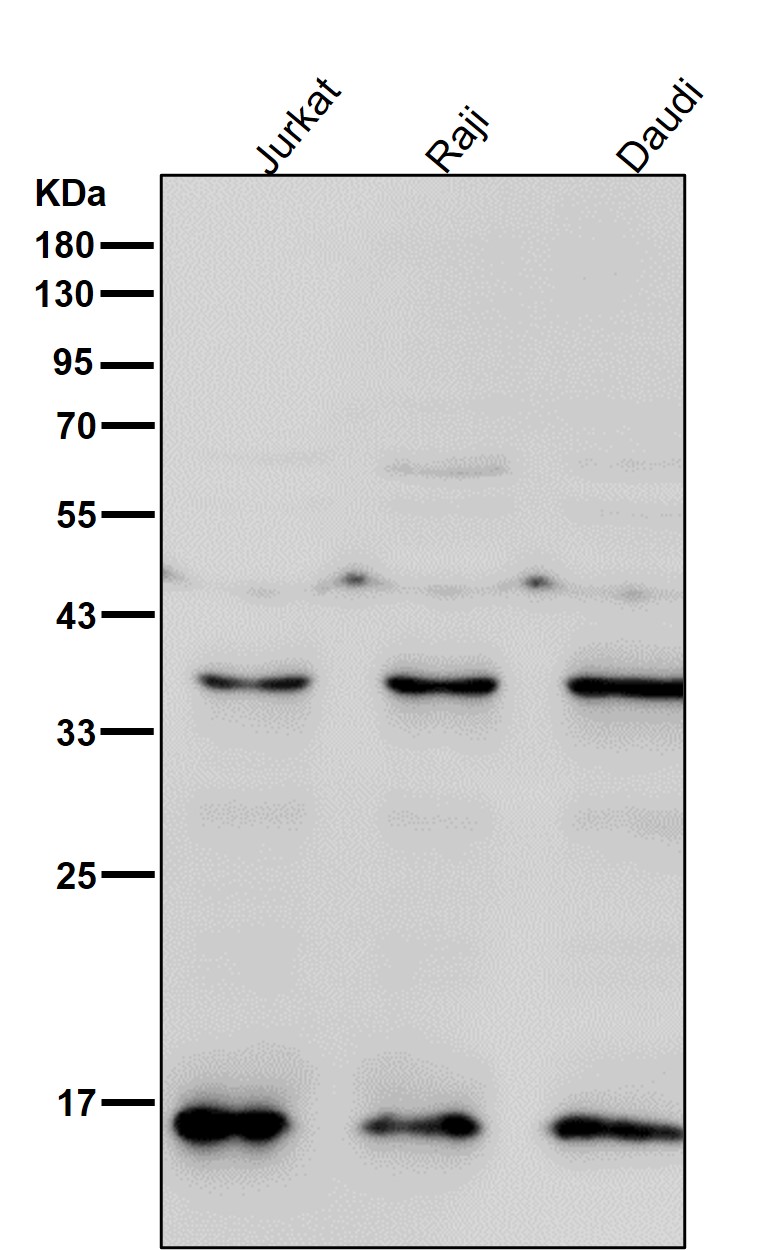 Rabbit Monoclonal to TRAPPC2