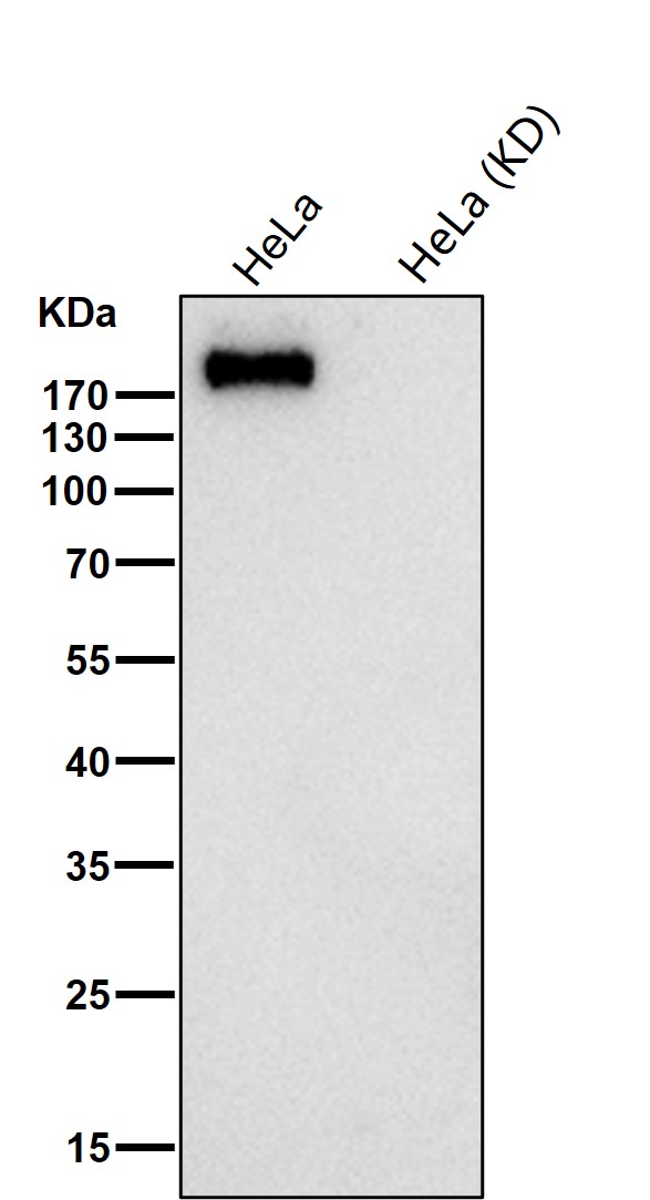 Rabbit Monoclonal to DENN
