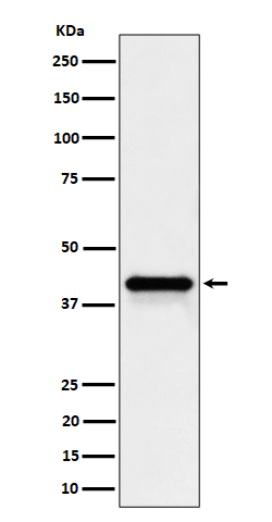 Wnt16