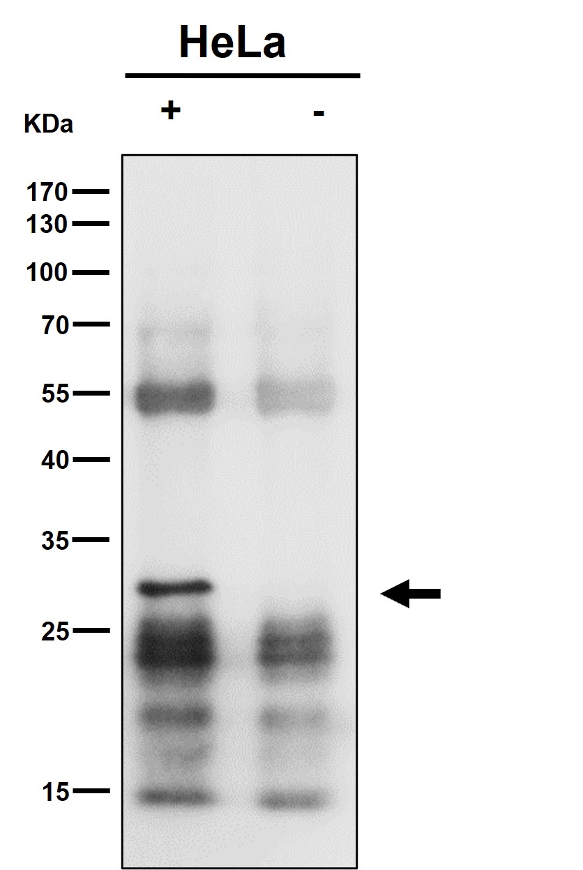 Rabbit Monoclonal to MTAP