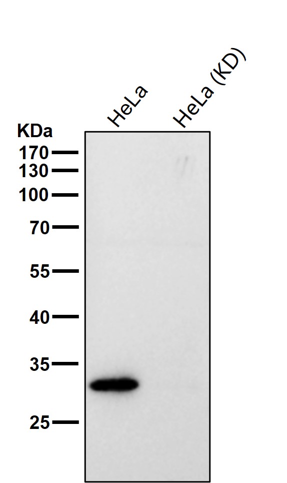 Rabbit Monoclonal to MTAP