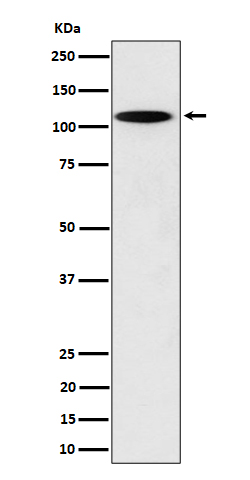 N4BP1