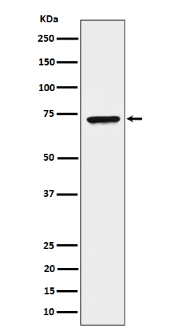 CTPsynthase/CTPS