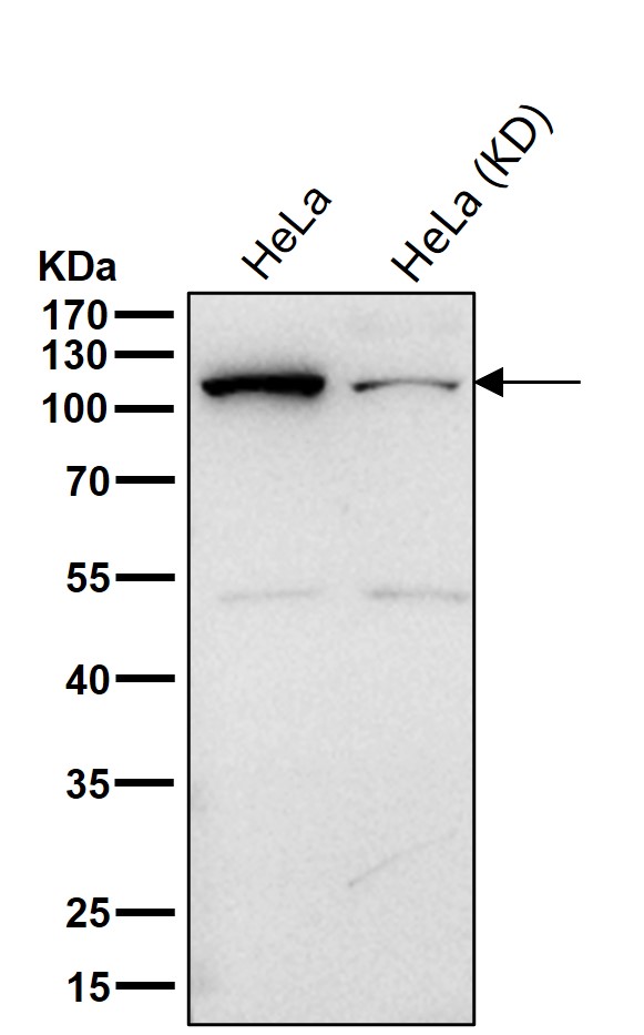 Rabbit Monoclonal to SPINK5/LEKTI