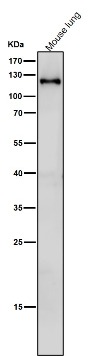 Rabbit Monoclonal to SPINK5/LEKTI