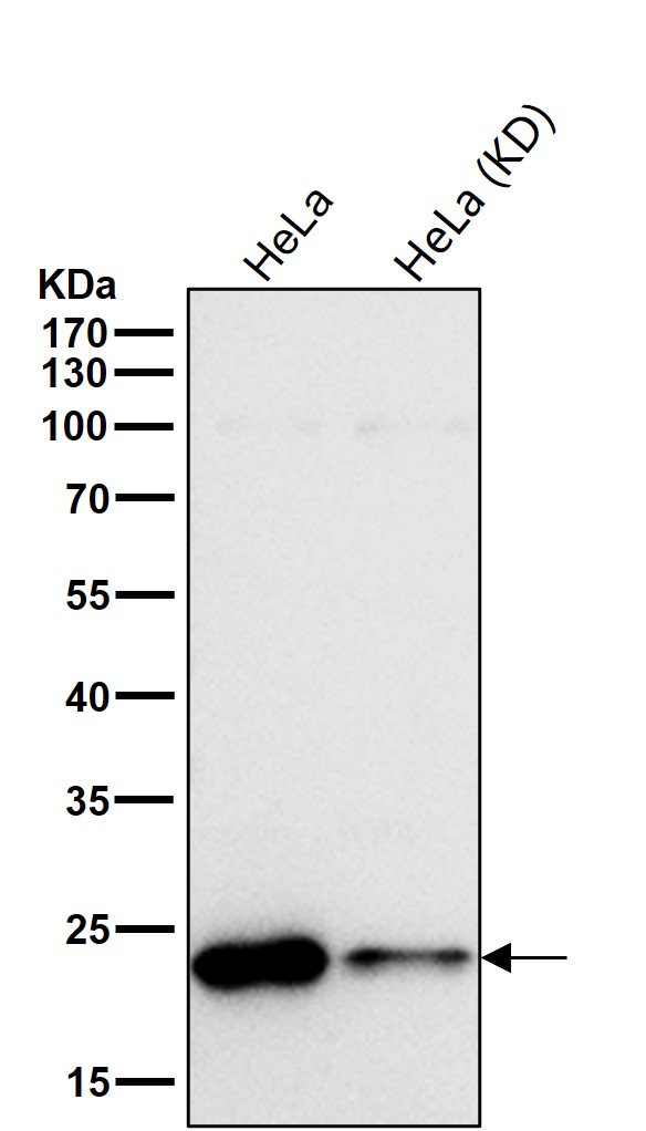 Rabbit Monoclonal to DTYMK