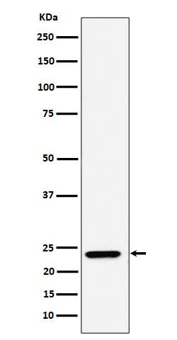 DNAJC12