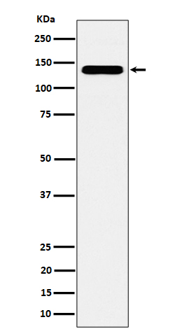 CYFIP1