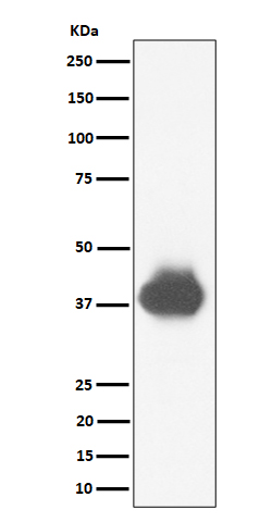 CD32A+CD32B+CD32C