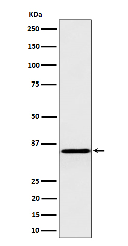 Pyrophosphatase 1