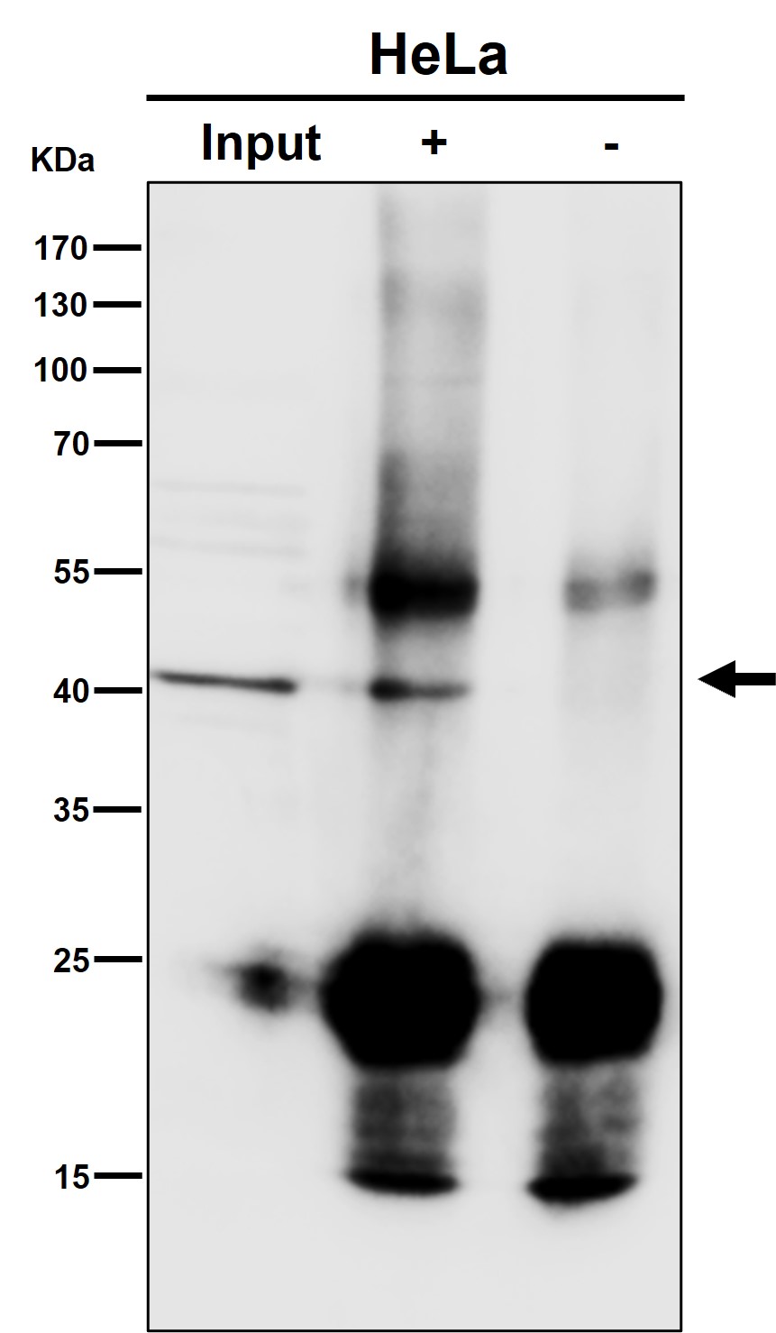 Rabbit Monoclonal to ACAT1