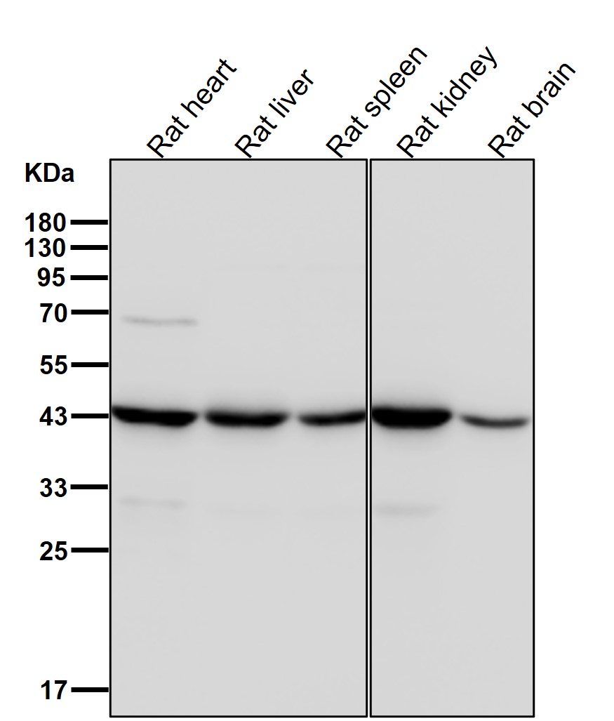 Rabbit Monoclonal to ACAT1