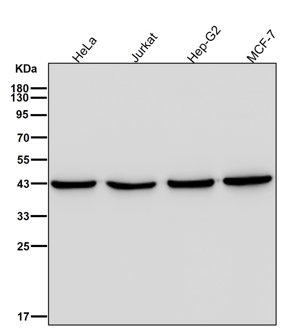 Rabbit Monoclonal to ACAT1