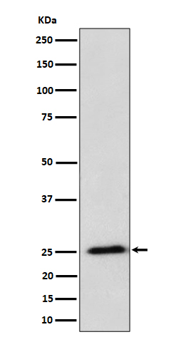 RPL10A