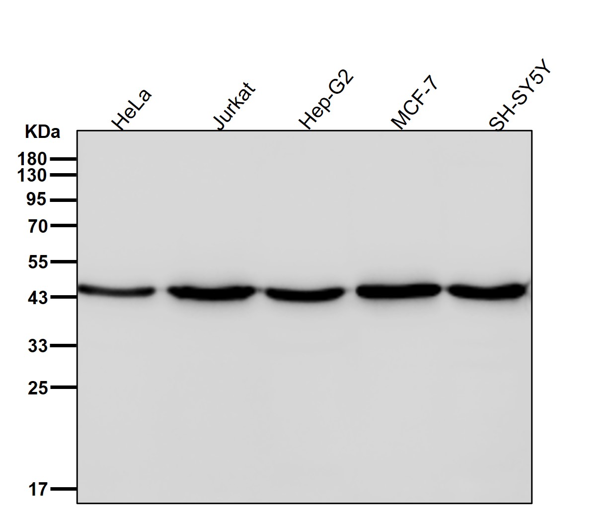Rabbit Monoclonal to AdSS2