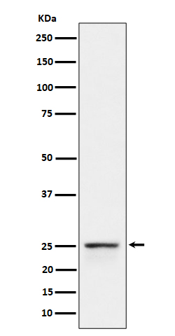 PEX11B