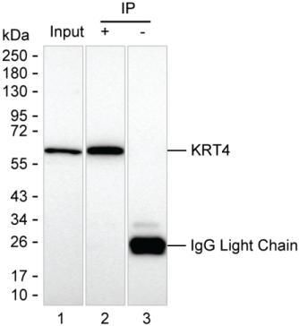 KRT4