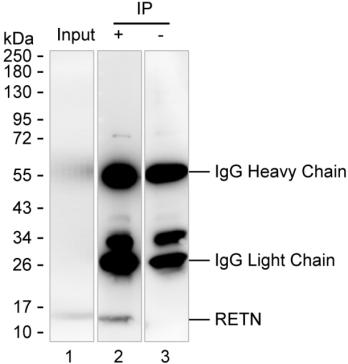 Mouse Monoclonal Antibody to RETN