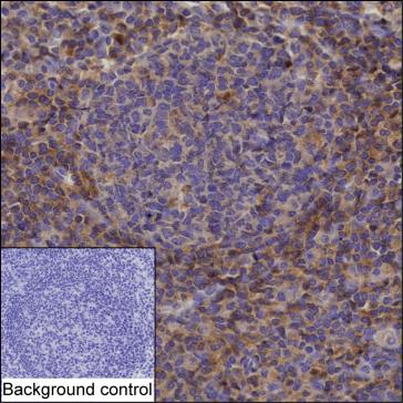 Mouse Monoclonal Antibody to PRKCB