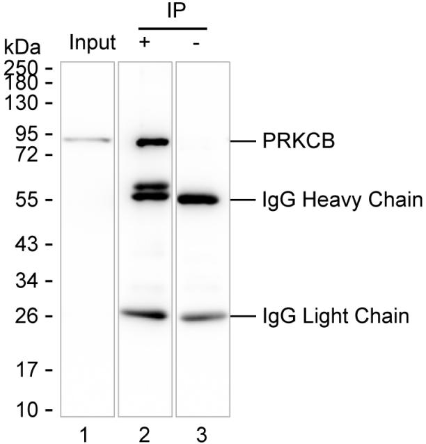PRKCB