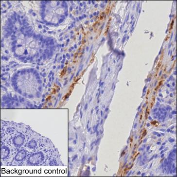 Mouse Monoclonal Antibody to TGM2