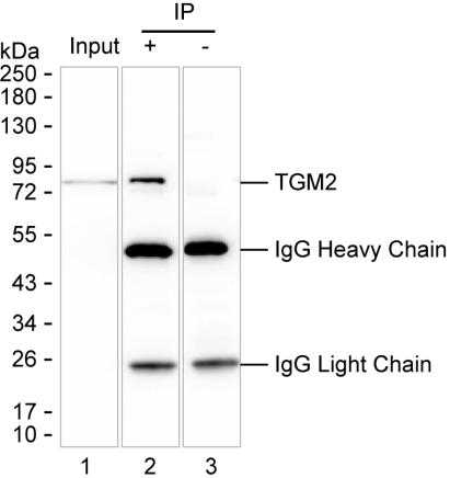 Mouse Monoclonal Antibody to TGM2