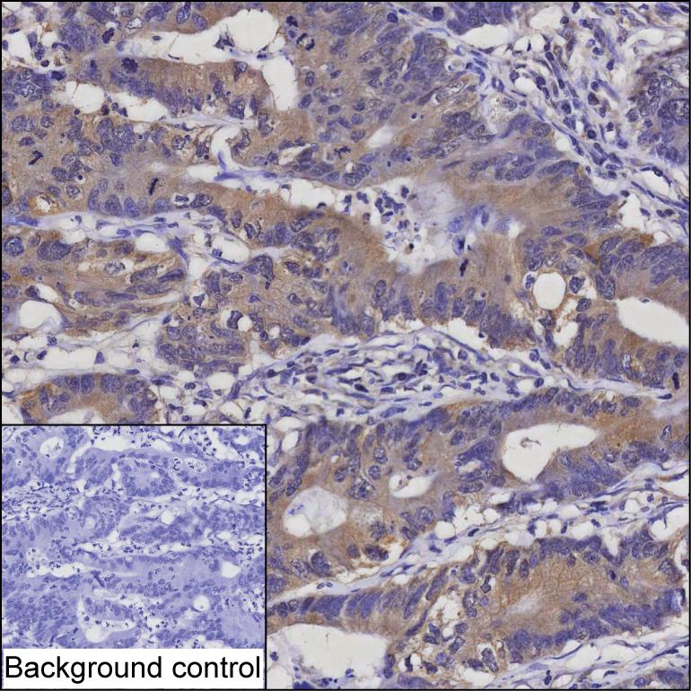 Mouse Monoclonal Antibody to ABRAXAS2