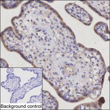 Mouse Monoclonal Antibody to TRIM34