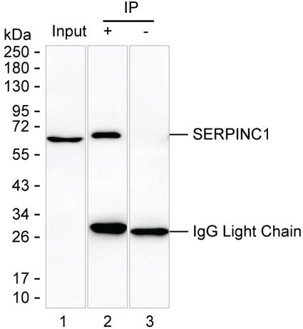 SERPINC1