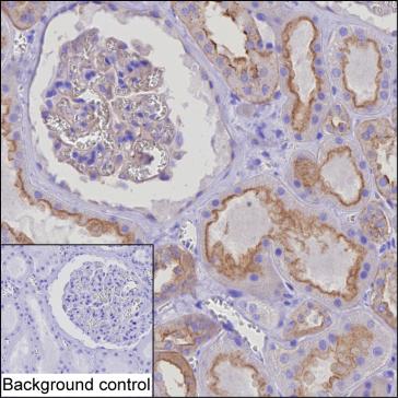 Mouse Monoclonal Antibody to HIP1R