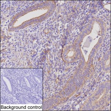 Mouse Monoclonal Antibody to ENAH