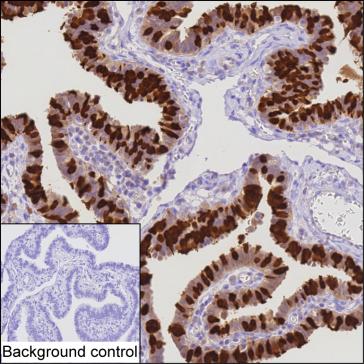Mouse Monoclonal Antibody to CAPS
