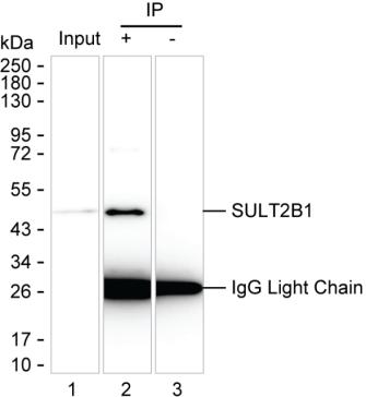 SULT2B1