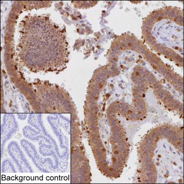 Mouse Monoclonal Antibody to PRKCD
