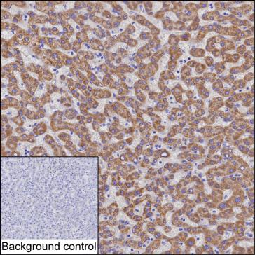 Mouse Monoclonal Antibody to MMAB