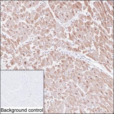 Mouse Monoclonal Antibody to CAMK2D