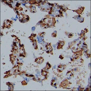 Rat Monoclonal Antibody to FGA